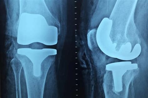 ortopedi nedir neye bakar